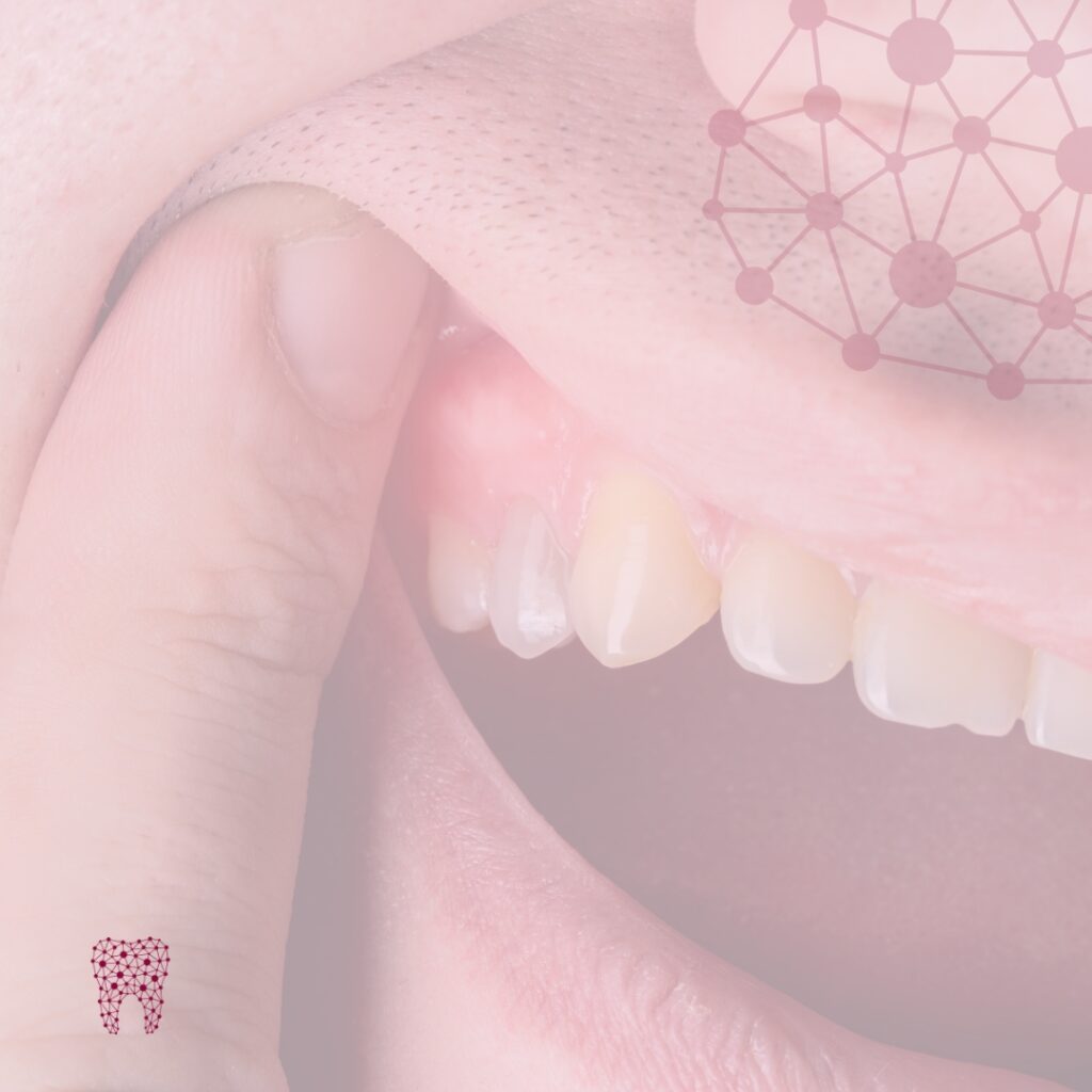 Blog Mayo 24 -Centro Dental Dra. Mayte Montesinos - Dentistas en Pilar de la Horadada, Alicante