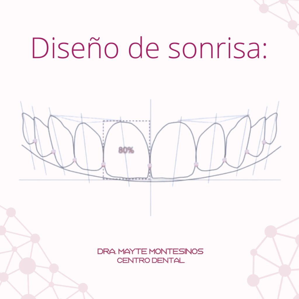Blog- Abril- Centro Dental Dra. Mayte Montesinos - Dentistas en Pilar de la Horadada, Alicante