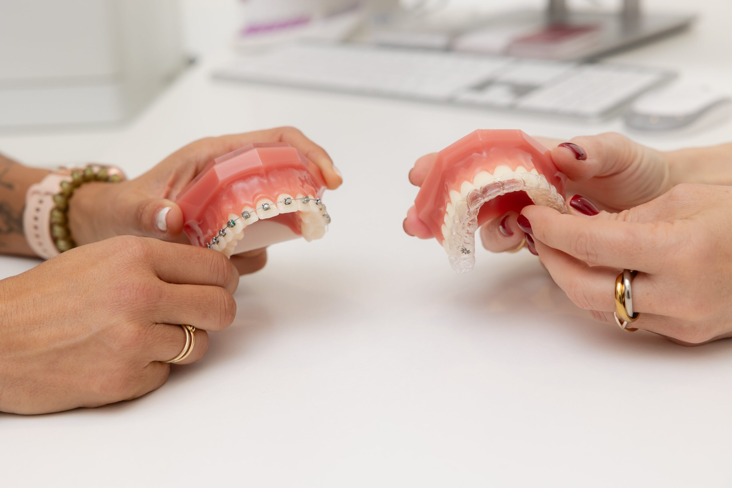 Prótesis dental - Centro Dental Dra. Mayte Montesinos - Dentistas en Pilar de la Horadada, Alicante